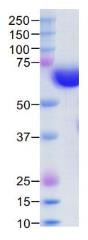 SDS-PAGE (ST6GAL1-14H).jpg
